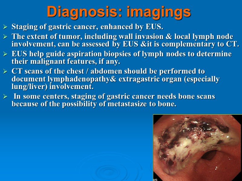 Diagnosis: imagings Staging of gastric cancer, enhanced by EUS.  The extent of tumor,